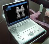 V9 Veterinary Laptop Ultrasound B scanner(ultrasound,ultrasoni,black white,scanner) SonoStar